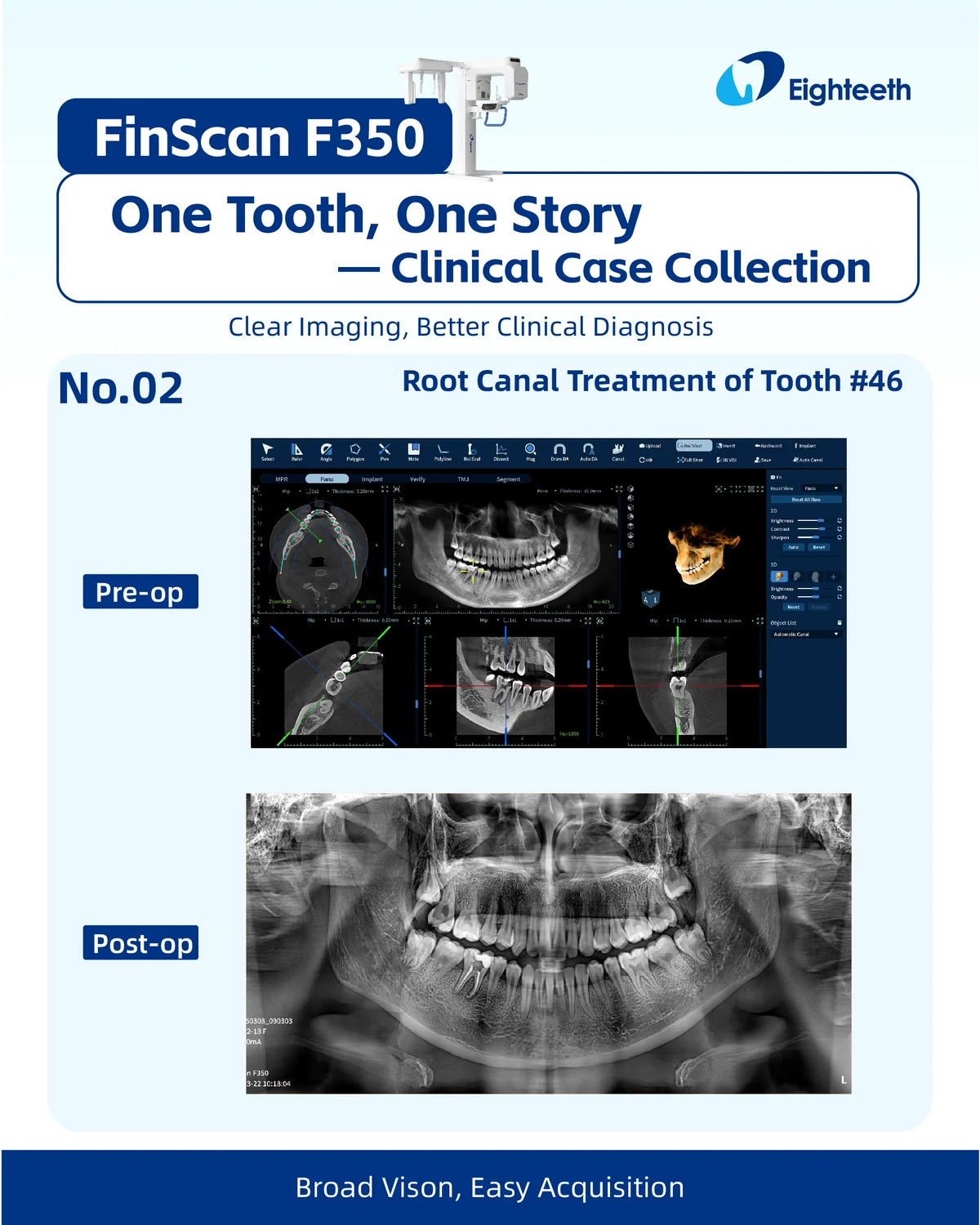FinScan F350 კლინიკური ქეისის პრომო მასალა